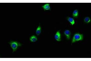 Immunofluorescence staining of A549 cells with ABIN7160157 at 1:150, counter-stained with DAPI. (SLC16A11 anticorps  (AA 428-471))