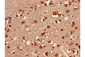 Immunohistochemistry of paraffin-embedded human brain tissue using ABIN7158098 at dilution of 1:100
