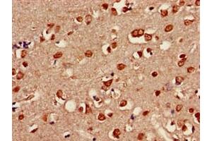 Immunohistochemistry of paraffin-embedded human brain tissue using ABIN7158098 at dilution of 1:100 (SHoc2/Sur8 anticorps  (AA 3-89))