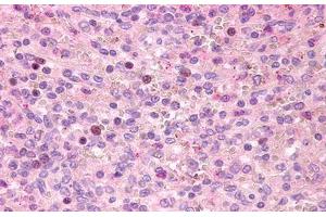 Image no. 1 for anti-G Protein-Coupled Receptor 171 (GPR171) (Extracellular Domain) antibody (ABIN1048755)