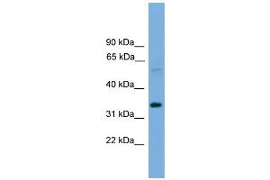 WB Suggested Anti-TM7SF4 Antibody Titration:  0. (Transmembrane 7 Superfamily Member 4 (TM7SF4) (N-Term) anticorps)