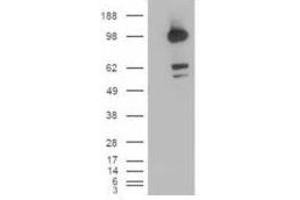 Image no. 1 for anti-CUB Domain Containing Protein 1 (CDCP1) (C-Term), (Isoform 1) antibody (ABIN374144) (CDCP1 anticorps  (C-Term, Isoform 1))