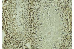 ABIN6269090 at 1/100 staining Mouse testis tissue by IHC-P. (Integrin beta 3 anticorps  (C-Term))