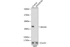 Western blot analysis of extracts from normal (control) and SEC61B knockout (KO) 293T cells, using SEC61B antibody (ABIN7270173) at 1:1000 dilution. (SEC61B anticorps  (AA 1-96))