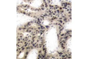 Immunohistochemistry (IHC) image for anti-Eukaryotic Translation Initiation Factor 4E Binding Protein 1 (EIF4EBP1) (pThr45) antibody (ABIN3019842) (eIF4EBP1 anticorps  (pThr45))