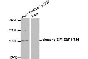 Western blot analysis of extracts of various cell lines, using EIF4EBP1 antibody. (eIF4EBP1 anticorps  (pThr37, pThr46))
