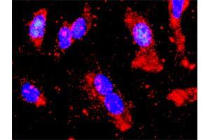 Proximity Ligation Analysis of protein-protein interactions between STK11 and PRKAA2.