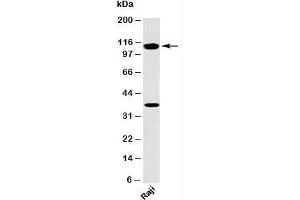 Western blot testing of human samples with TLR9 antibody at 2ug/ml. (TLR9 anticorps  (N-Term))