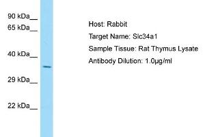 Host: Rabbit Target Name: Slc34a1 Sample Type: Rat Thymus lysates Antibody Dilution: 1. (Solute Carrier Family 34 (Type II Sodium/phosphate Contransporter), Member 1 (SLC34A1) (N-Term) anticorps)