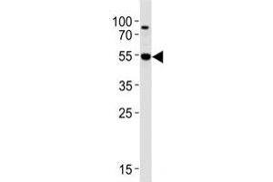 Western blot analysis of lysate from Jurkat cell line using AKT3 antibody at 1:1000.
