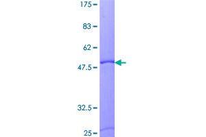 Image no. 1 for Myosin, Light Chain 6B, Alkali, Smooth Muscle and Non-Muscle (MYL6B) (AA 1-208) protein (GST tag) (ABIN1311775)