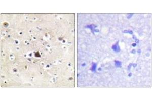 Immunohistochemistry (IHC) image for anti-Nuclear Receptor Subfamily 3, Group C, Member 1 (Glucocorticoid Receptor) (NR3C1) (AA 201-250) antibody (ABIN2888632)