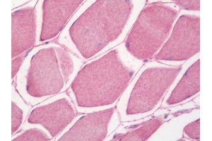 anti-NADH Dehydrogenase (Ubiquinone) 1 alpha Subcomplex, 1, 7.5kDa (NDUFA1) antibody (FITC)