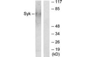 Western blot analysis of extracts from HepG2 cells, using SYK Antibody. (SYK anticorps  (AA 141-190))