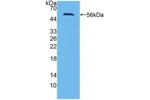 Detection of Recombinant AASS, Human using Polyclonal Antibody to Aminoadipate Semialdehyde Synthase (AASS)