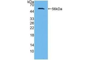 Detection of Recombinant AASS, Human using Polyclonal Antibody to Aminoadipate Semialdehyde Synthase (AASS) (AASS anticorps  (AA 33-455))