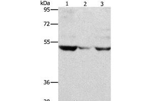 Western Blot analysis of PC3 cell and Mouse muscle tissue, A375 cell using MMP1 Polyclonal Antibody at dilution of 1:500 (MMP1 anticorps)