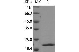 Western Blotting (WB) image for Fibroblast Growth Factor 8 (Androgen-Induced) (FGF8) (Active) protein (ABIN7198878) (FGF8 Protéine)