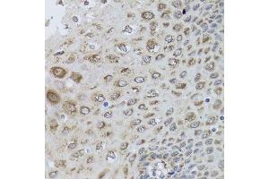 Immunohistochemistry of paraffin-embedded human esophagus using PRKAB1 antibody.