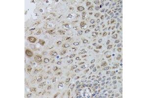 Immunohistochemistry of paraffin-embedded human esophagus using PRKAB1 antibody. (PRKAB1 anticorps  (AA 1-80))