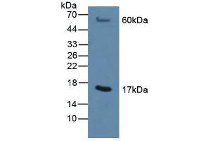 Figure. (MGST1 anticorps  (AA 8-155))