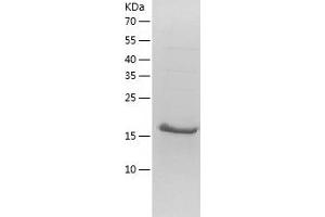 Western Blotting (WB) image for Nudix (Nucleoside Diphosphate Linked Moiety X)-Type Motif 4 (NUDT4) (AA 1-180) protein (His-IF2DI Tag) (ABIN7124245)