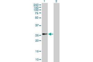 Western Blot analysis of CCRK expression in transfected 293T cell line by CCRK MaxPab polyclonal antibody.