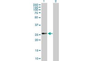 Western Blot analysis of CCRK expression in transfected 293T cell line by CCRK MaxPab polyclonal antibody. (CCRK anticorps  (AA 1-275))