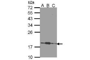 WB Image Sample (30 ug of whole cell lysate) A: 293T B: A431 , C: H1299 12% SDS PAGE antibody diluted at 1:1000 (COMMD7 anticorps)