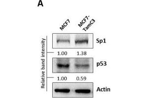 HDAC2 positively regulates the expression of Sp1 and negatively regulates the expression of p53 in ER+ breast cancer cells.