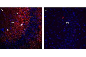 Expression of Synaptophysin in rat hippocampus.