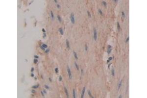 IHC-P analysis of Human Tissue, with DAB staining. (FBXO32 anticorps  (AA 1-201))