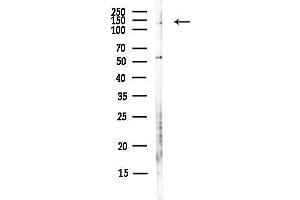 anti-Phosphoribosylformylglycinamidine Synthase (PFAS) antibody