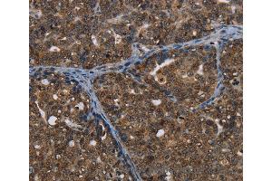 Immunohistochemistry of Human brain  using CERS6 Polyclonal Antibody at dilution of 1:35 (CERS6 anticorps)