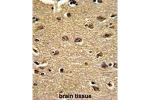 Immunohistochemistry (IHC) image for anti-Clusterin Associated Protein 1 (CLUAP1) antibody (ABIN3002721)
