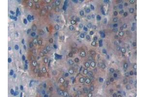 DAB staining on IHC-P; Samples: Rat Adrenal gland Tissue