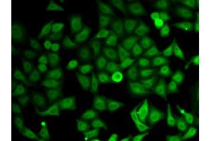 anti-IMP (Inosine 5'-Monophosphate) Dehydrogenase 2 (IMPDH2) (AA 215-514) antibody