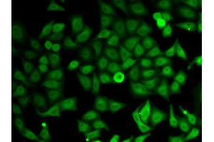 Immunofluorescence analysis of HeLa cells using IMPDH2 antibody (ABIN6130493, ABIN6142435, ABIN6142436 and ABIN6220985).
