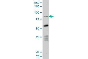 Western Blotting (WB) image for anti-Deleted in Azoospermia 1 (DAZ1) (AA 21-121) antibody (ABIN598639) (DAZ1 anticorps  (AA 21-121))