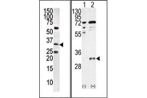 Image no. 1 for anti-CTD (Carboxy-terminal Domain, RNA Polymerase II, Polypeptide A) Small Phosphatase 1 (CTDSP1) (AA 1-250), (C-Term), (N-Term) antibody (ABIN360805)