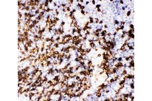IHC-P: CD20 antibody testing of human tonsil tissue (CD20 anticorps  (AA 1-261))
