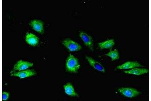 Immunofluorescent analysis of Hela cells cells using ABIN7170565 at dilution of 1:100 and Alexa Fluor 488-congugated AffiniPure Goat Anti-Rabbit IgG(H+L)