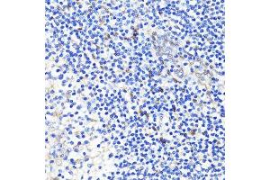 Immunohistochemistry of paraffin-embedded human tonsil using YAP1 antibody.