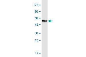 Western Blot detection against Immunogen (55. (TMIGD1 anticorps  (AA 1-262))