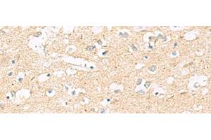 Immunohistochemistry of paraffin-embedded Human brain tissue using MRPL20 Polyclonal Antibody at dilution of 1:60(x200)