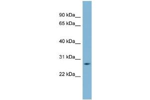 WB Suggested Anti-GAMT Antibody Titration:  0. (GAMT anticorps  (Middle Region))