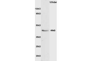 Rat liver lysate probed with Anti VASH1 Polyclonal Antibody, Unconjugated  at 1:3000 for 90 min at 37˚C. (VASH1 anticorps  (AA 281-365))