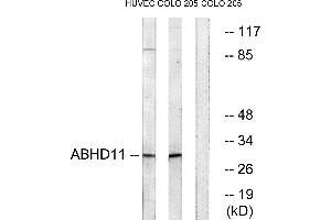 Western blot analysis of extracts from HUVEC cells and COLO cells, using ABHD11 antibody. (ABHD11 anticorps)
