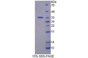 SDS-PAGE of Protein Standard from the Kit (Highly purified E. (LEFTY1 Kit CLIA)