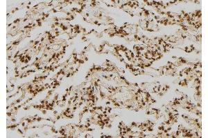ABIN6277324 at 1/100 staining Human lung tissue by IHC-P.